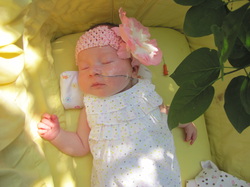 Prader-Willi Syndrome NG Tube, beautiful baby